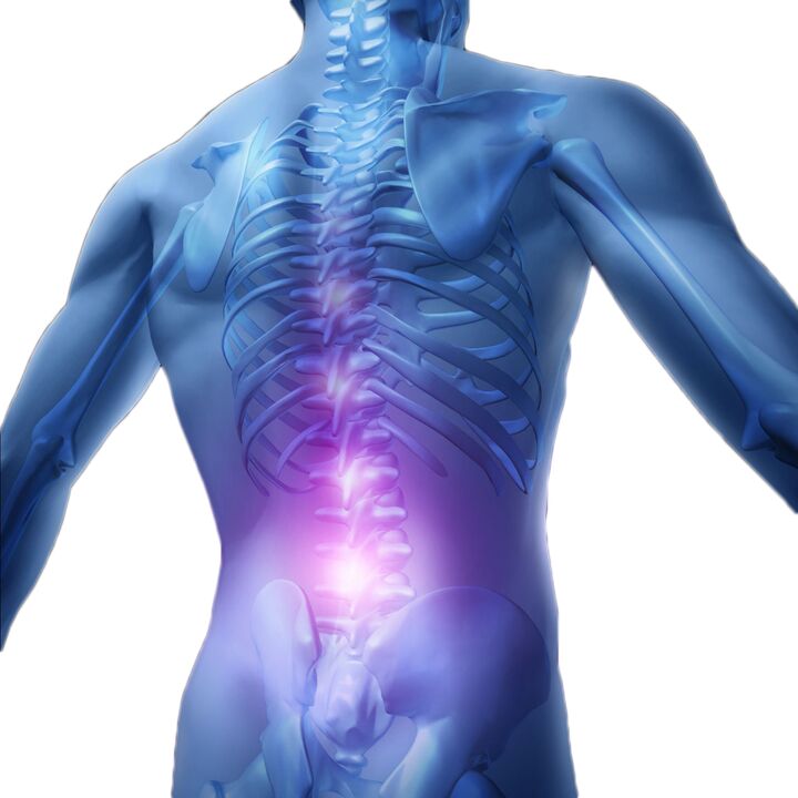 Muscle spasms and tightness cause intense pain